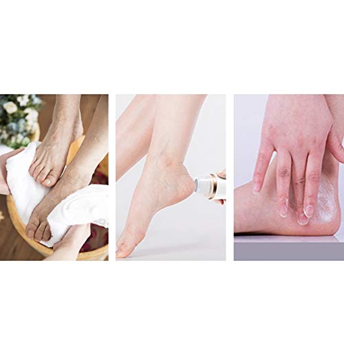 Rechargeable Electric Foot Grinder