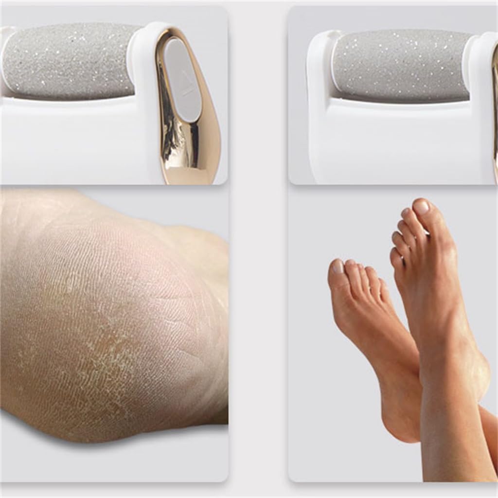 Rechargeable Foot Callus Trimmer