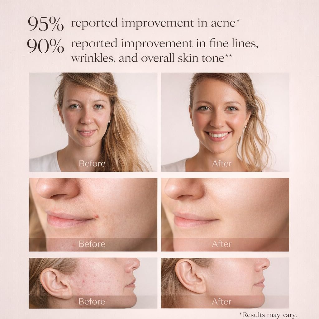 LED Face and Neck Light Therapy Mask