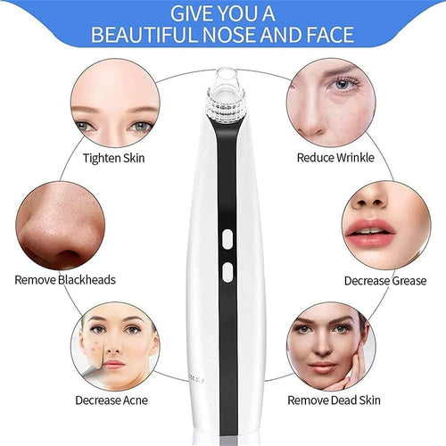 Adjustable Blackhead Pore Vacuum