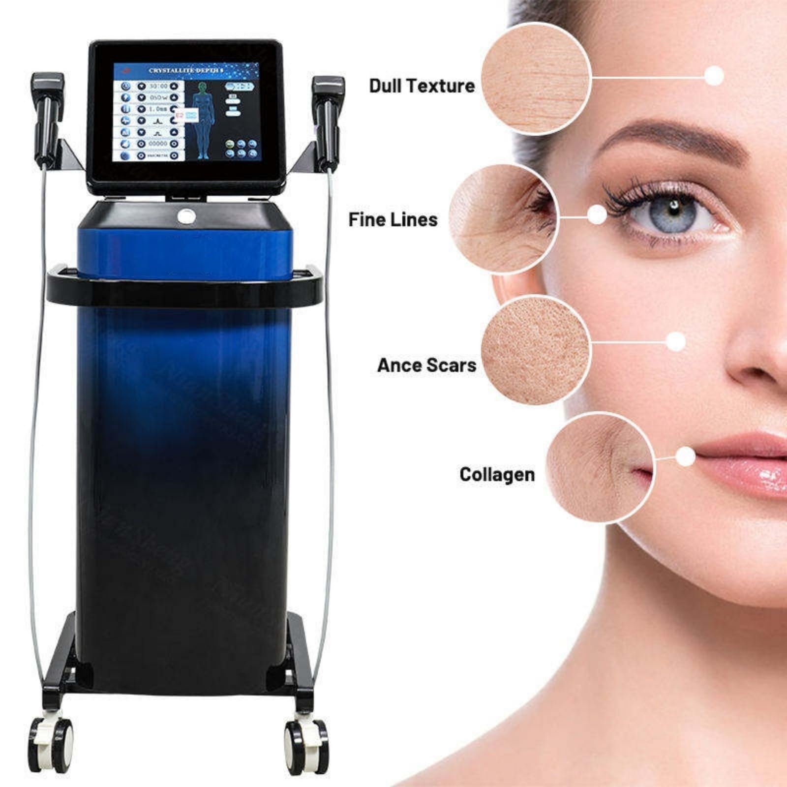 Facial and Body Skin Tightening Device