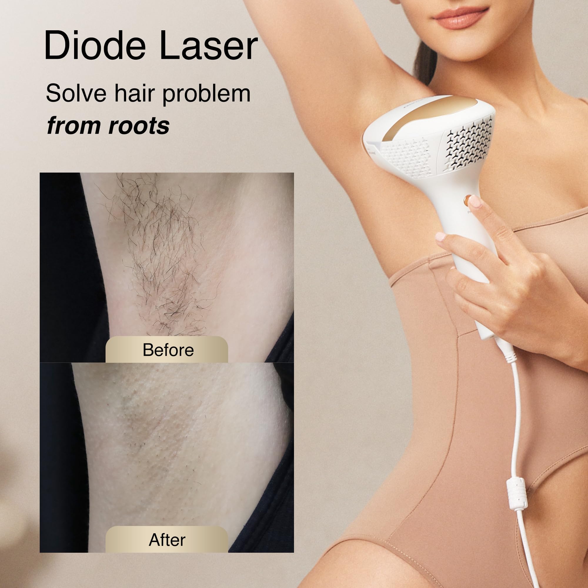 810nm Diode Hair Removal Device