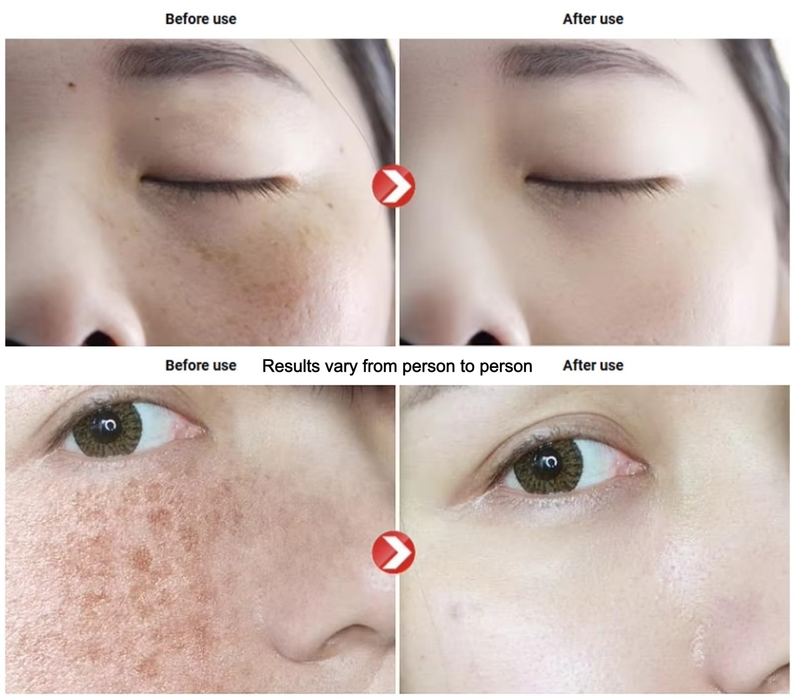 Plasma Facial Beauty Device