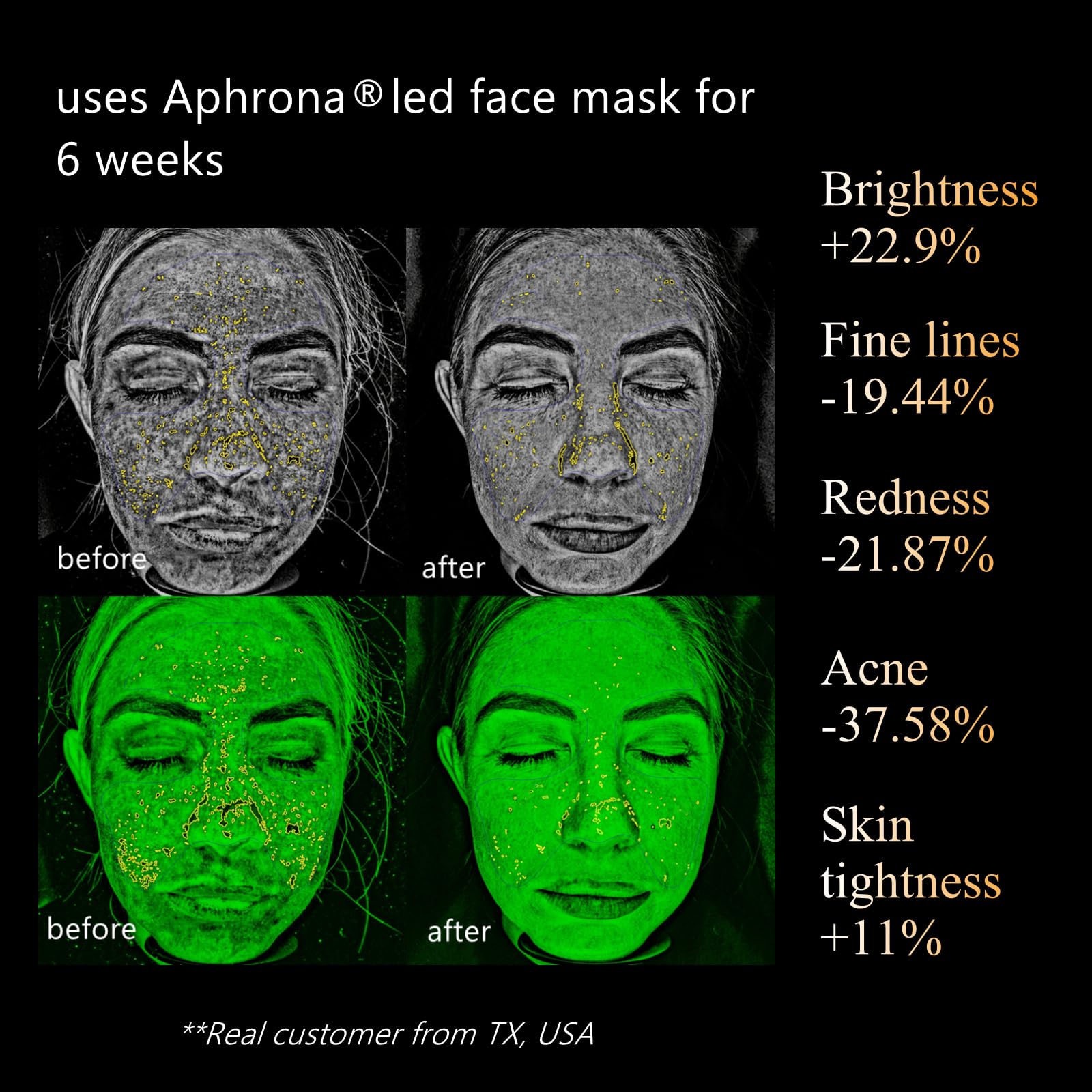 LED Face and Neck Light Therapy Mask